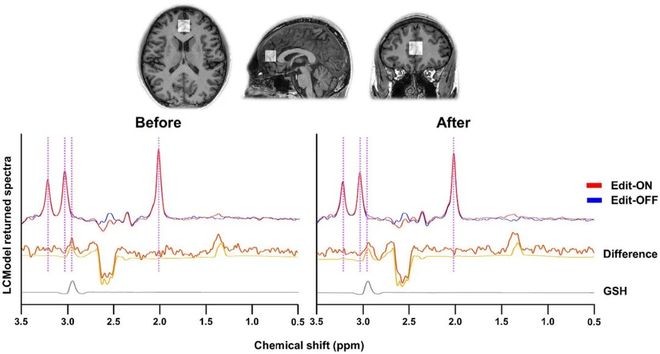头就能改善你的记忆力？九游会J9为什么嚼嚼木(图3)